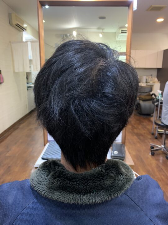 写真：Before