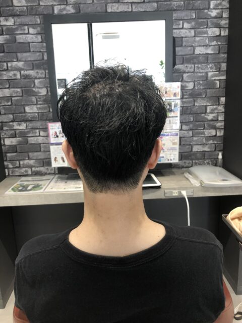 写真:After