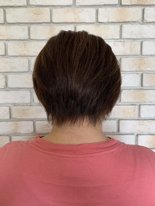 写真：After