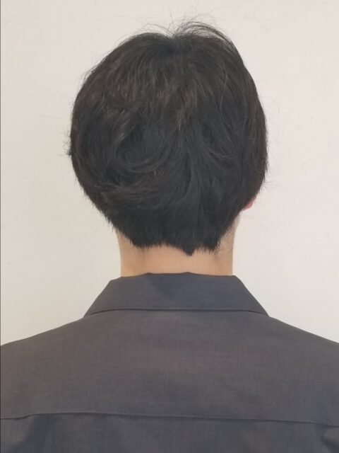 写真：Before