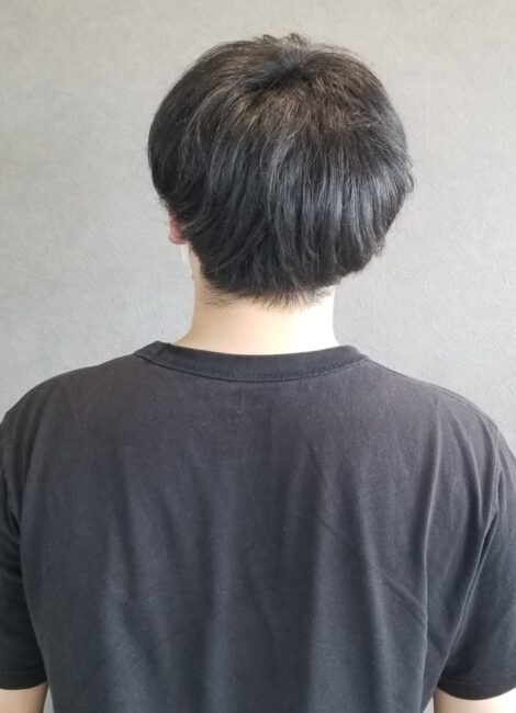 写真：Before