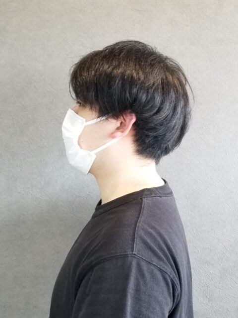 写真：Before