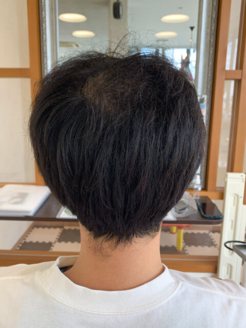 写真：Before