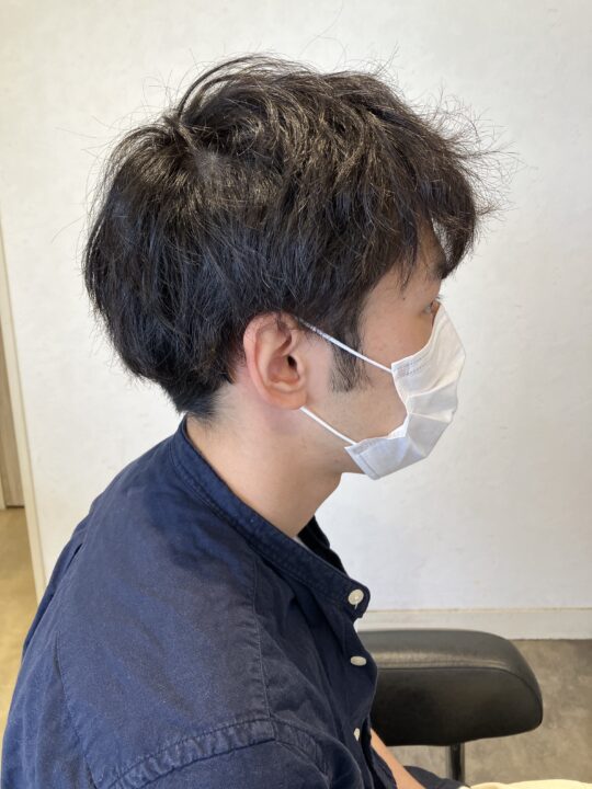 写真：Before