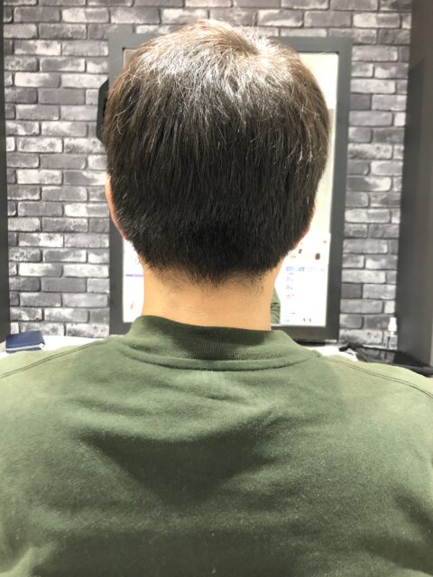 写真：Before