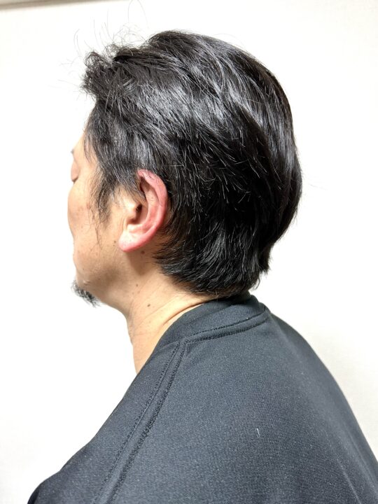 写真：Before