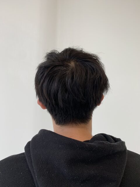 写真：Before