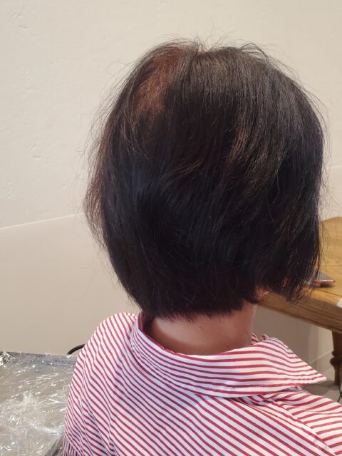 写真：Before