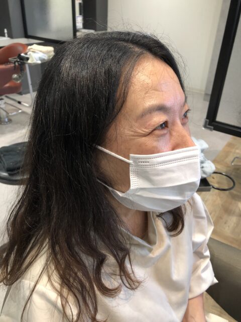 写真:Before