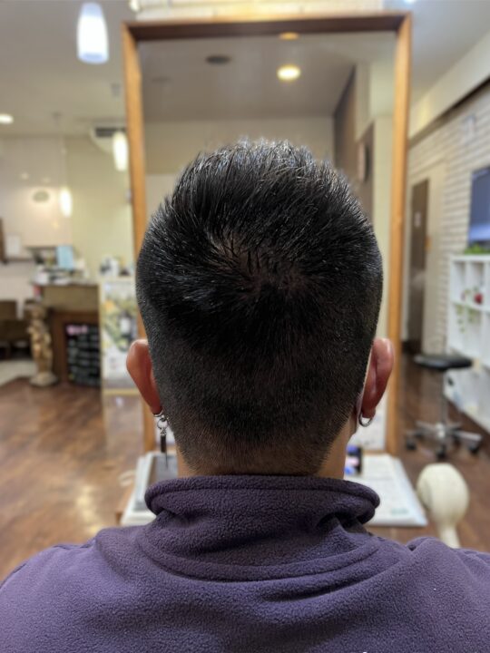 写真：After