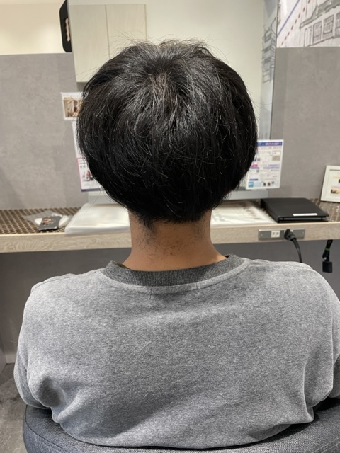 写真：Before