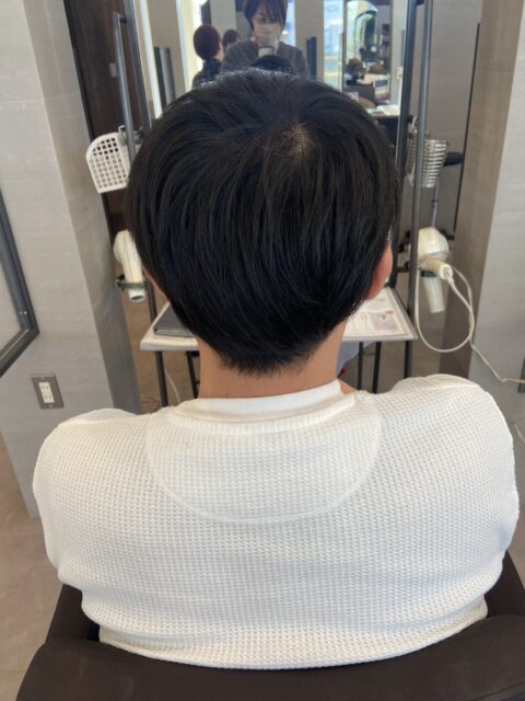 写真：Before