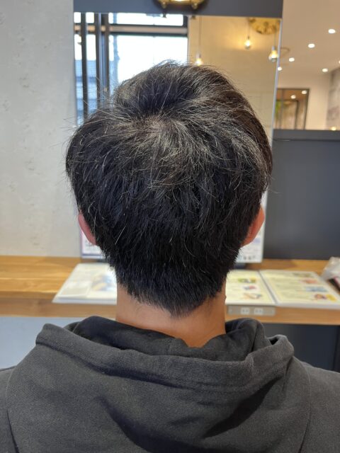 写真：Before