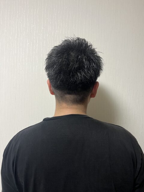 写真：After