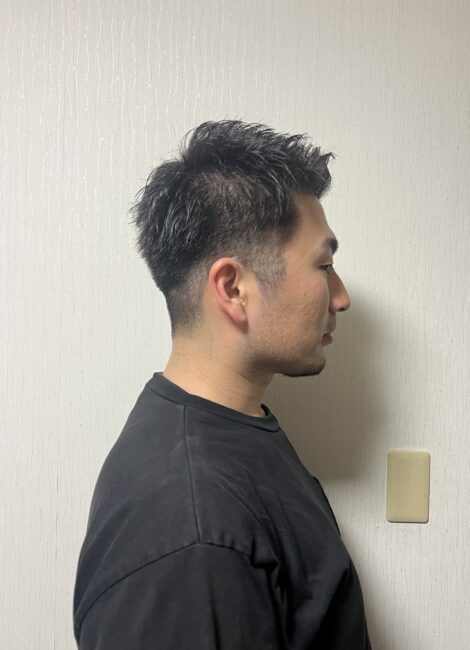 写真：After