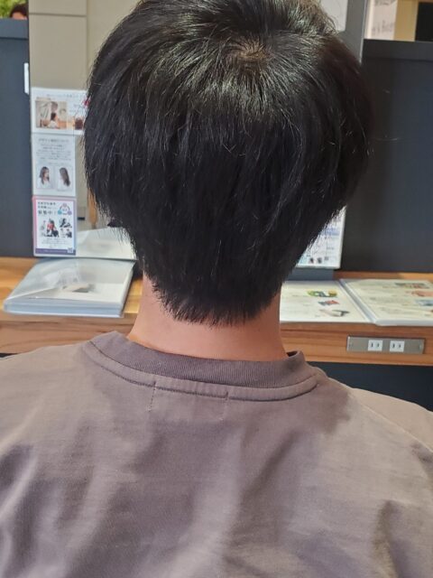 写真：Before