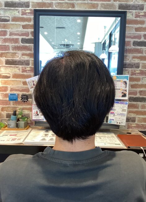 写真：Before