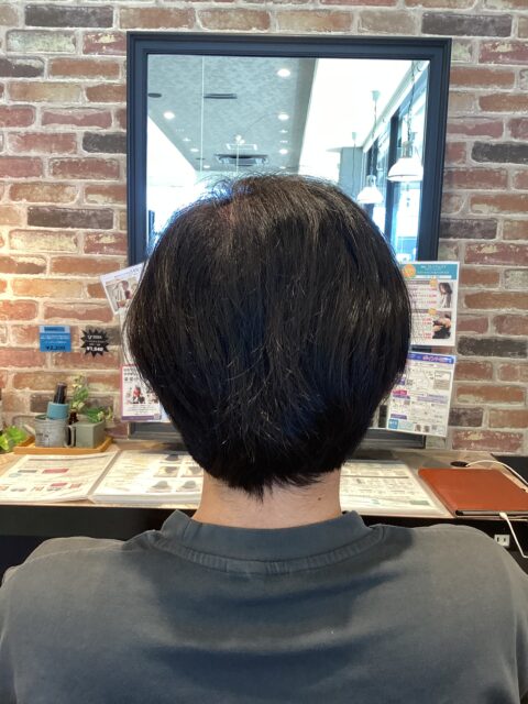 写真：Before