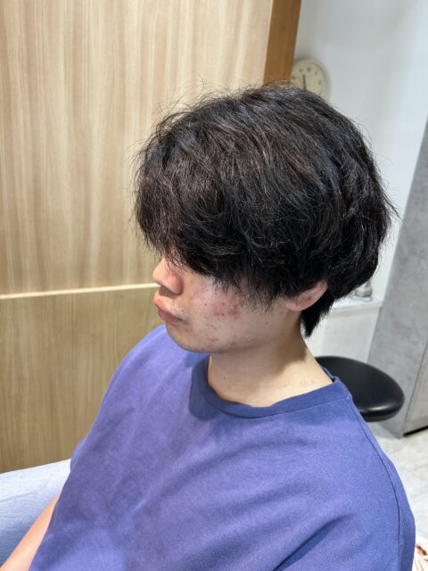 写真：Before