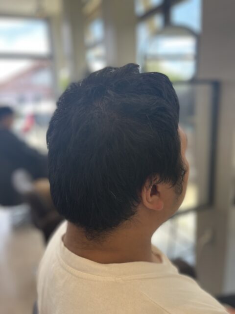 写真：Before