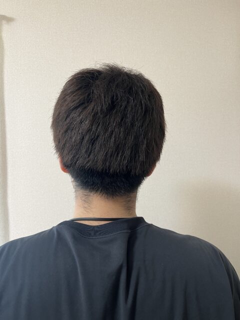 写真：Before