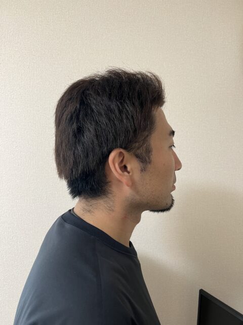 写真：Before