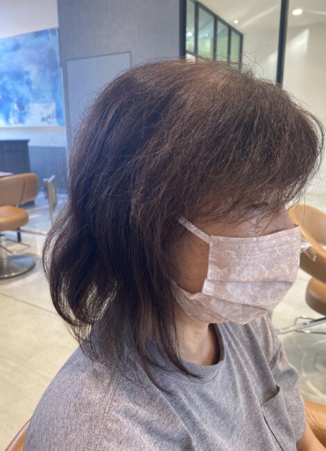 写真：Before