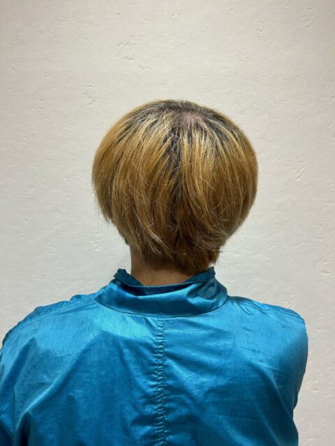 写真：Before