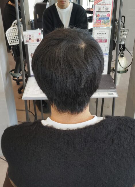 写真：Before