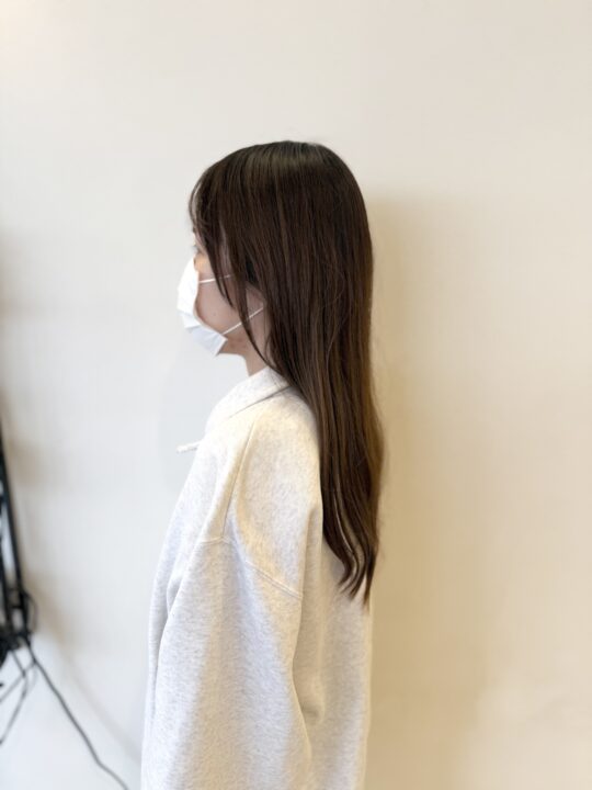 写真:Before