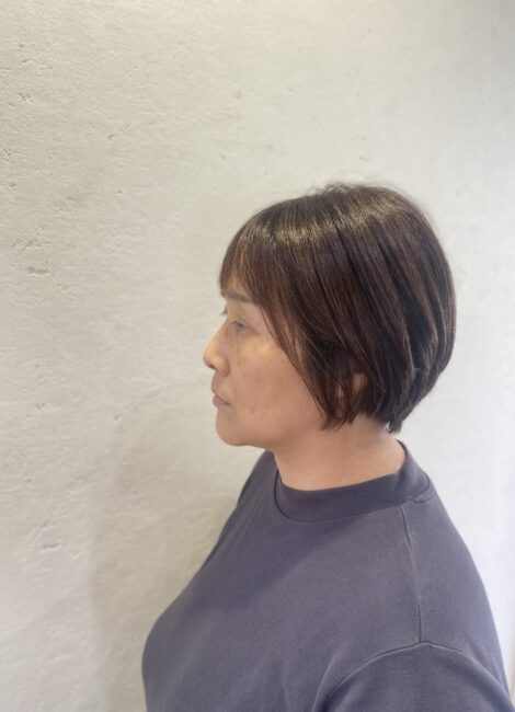 写真：After