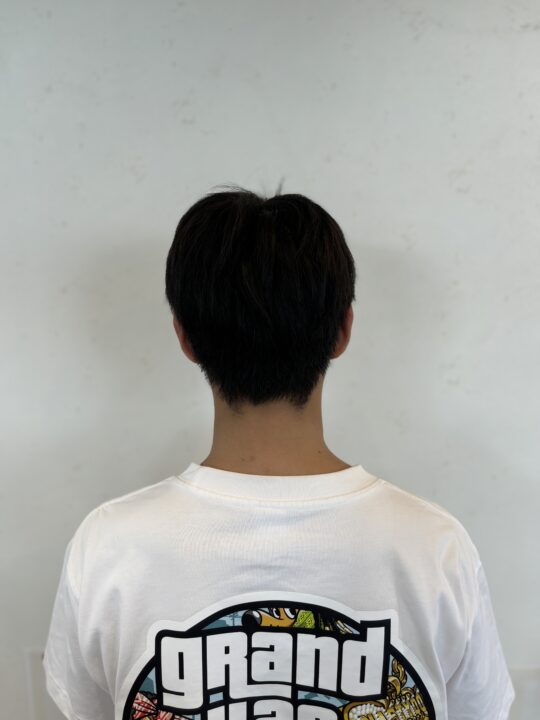 写真:Before