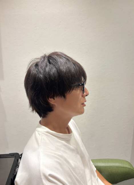 写真：Before