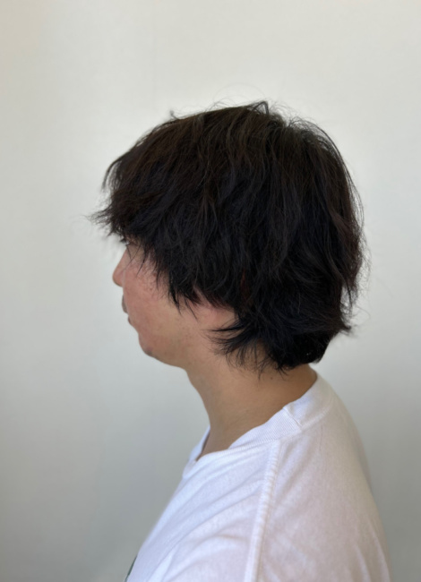 写真：Before