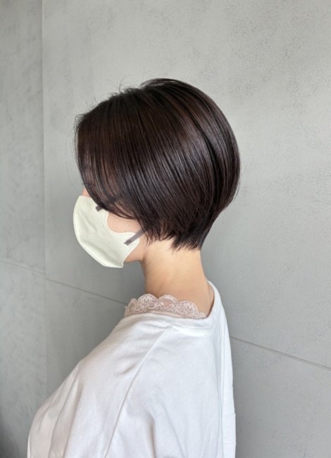 写真：After