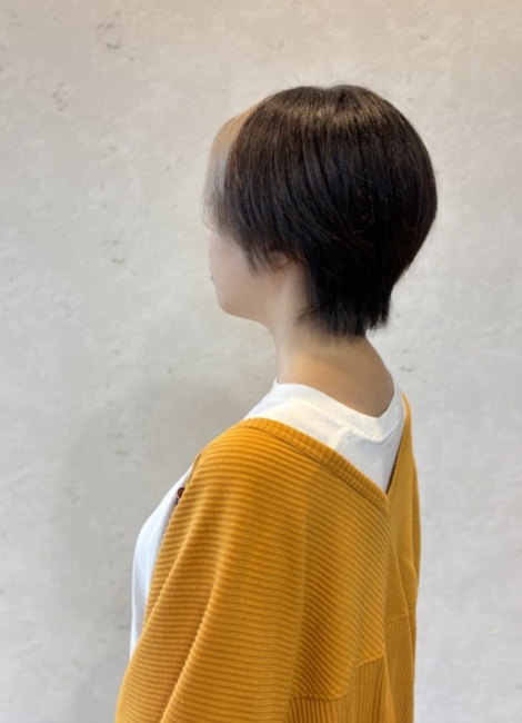 写真：After