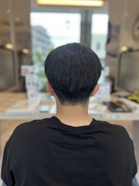 写真:Before