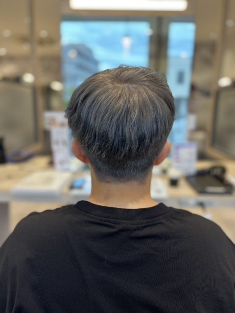 写真:After