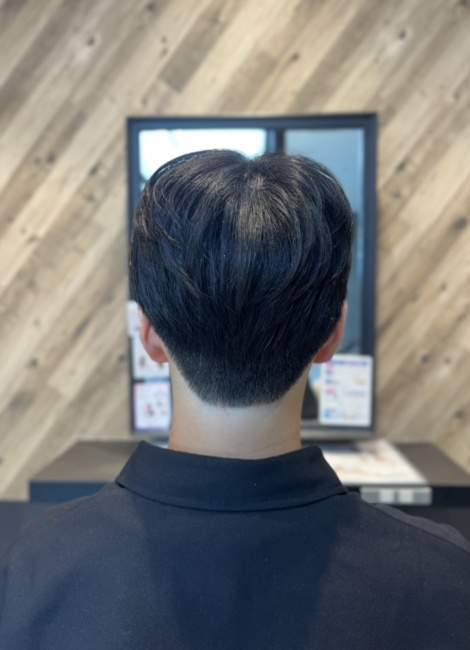 写真：After