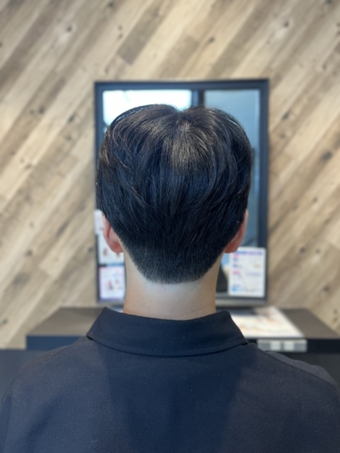写真：After