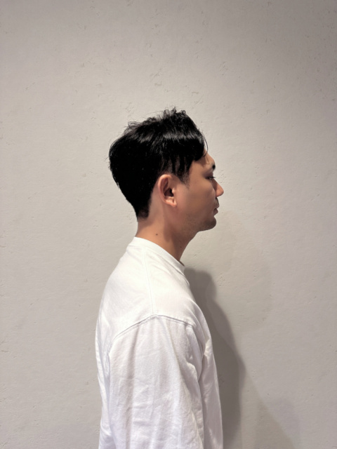写真:After