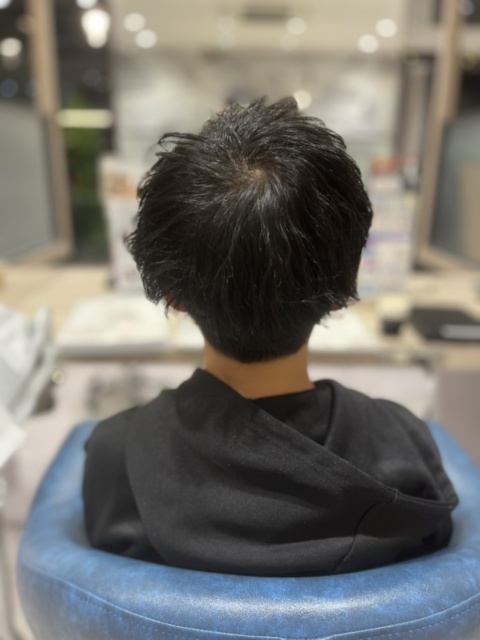 写真：After