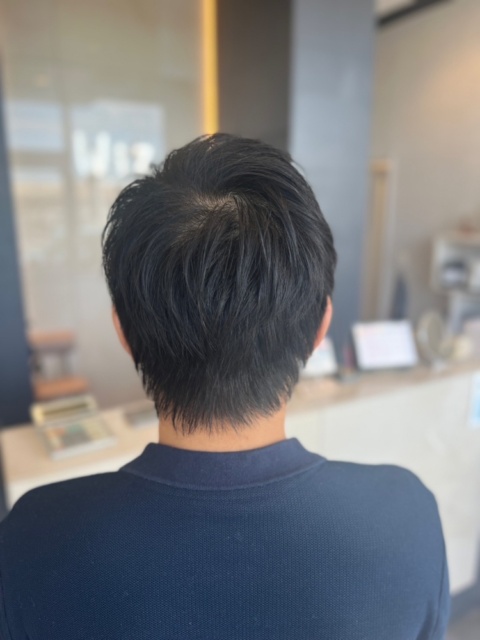 写真：After